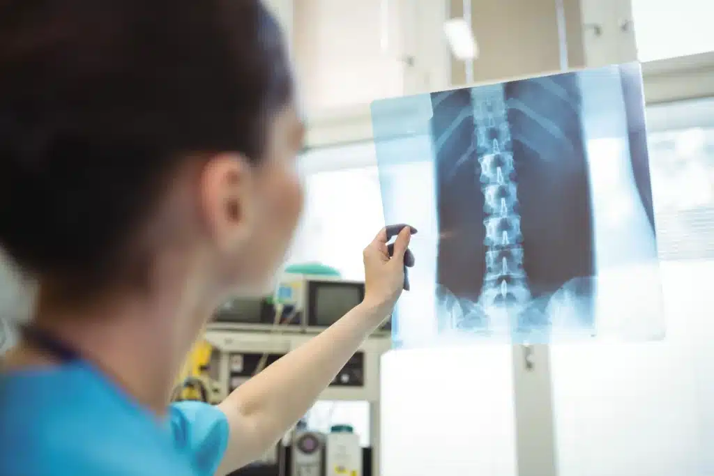 A nurse looking at a spinal cord x-ray
