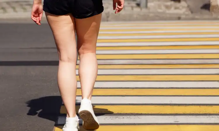 A pedestrian's legs going across a crosswalk in broad daylight.