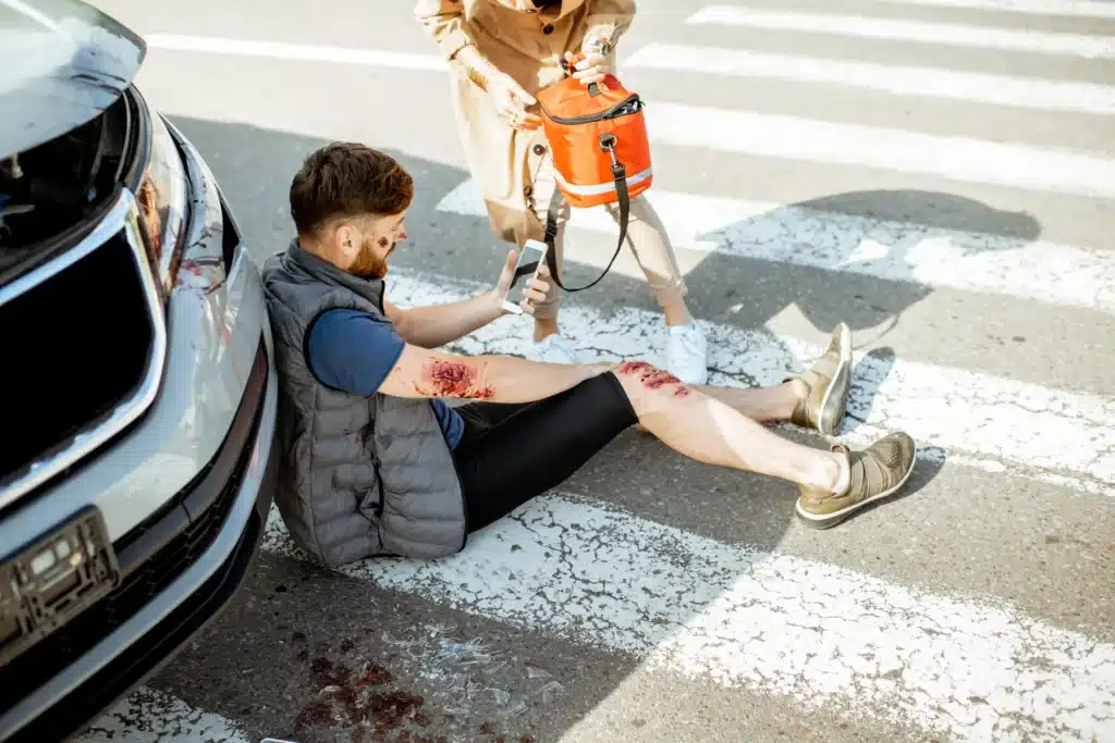 A man sitting on the road after an accident with bruise on the hand and leg