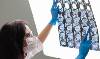 A doctor studying a brain x-ray