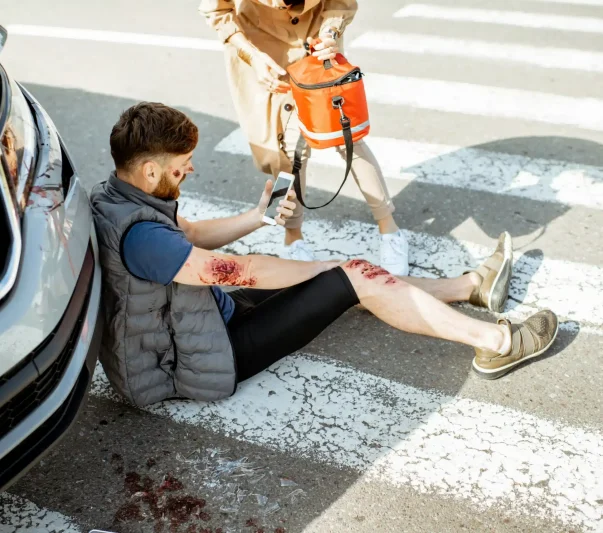 A man sitting on the road after an accident with bruise on the hand and leg