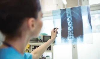 A nurse looking at a spinal cord x-ray