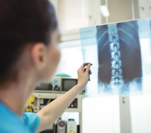 A nurse looking at a spinal cord x-ray